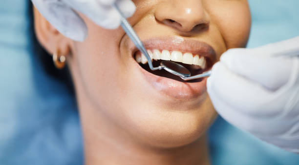 Best Emergency Dental Care for Broken or Chipped Teeth in San Juan Bautista, CA